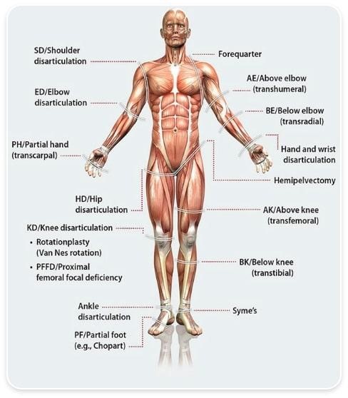 Prosthetic Solutions to Regain your Mobility at ALC AMTZ