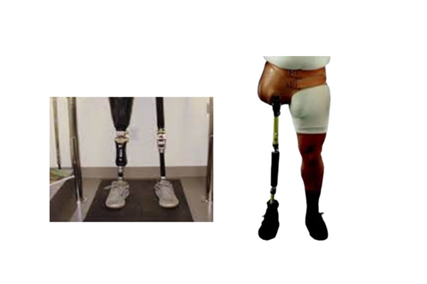ALC Lower Extermity Trans Pelvic Prosthesis Care at AMTZ Campus