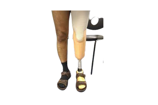ALC AMTZ Lower Extermity Trans Tibial Prosthesis Care
