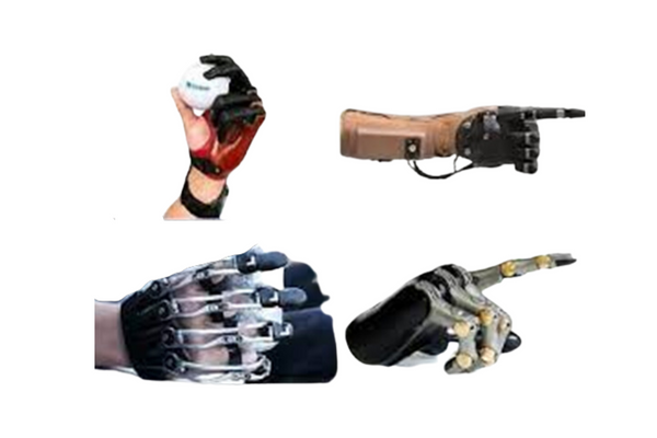 Wrist Disarticulation Prosthesis Solutions at ALC AMTZ