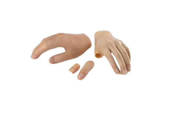 Partial Hand Prosthesis Solutoins and Cosmetic Restoration at ALC AMTZ